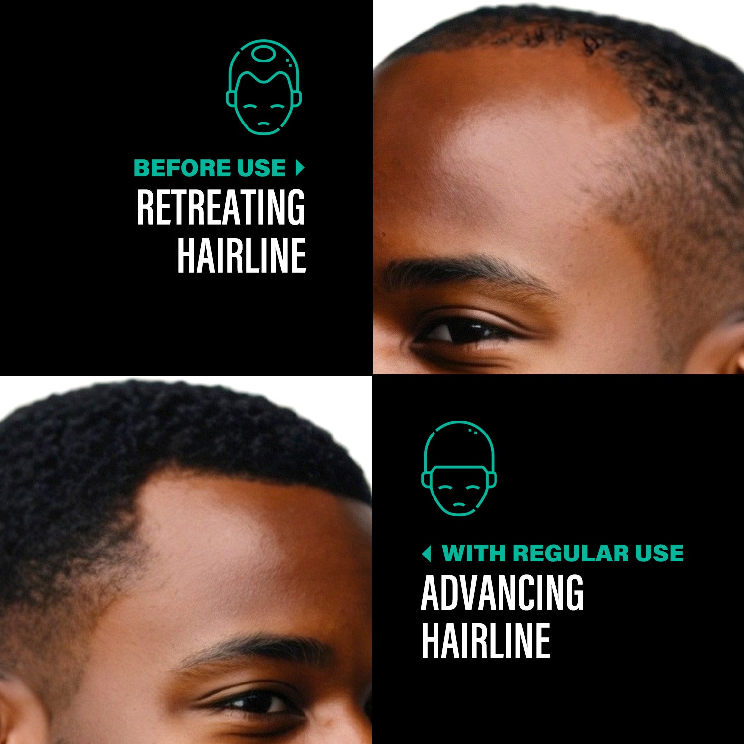 100% Unrefined Batana Oil 4oz